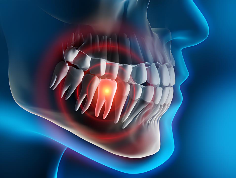 Teeth image - Emergency dentist Horsham